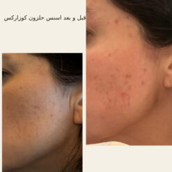 اسنس حلزون کوزارکس (100% اصل+به قیمت پخش) 27 before after hair oridinary 18 510x510 5