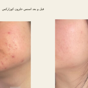 before after hair oridinary 18 510x510 6