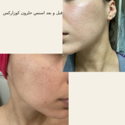 اسنس حلزون کوزارکس (100% اصل+به قیمت پخش) 34 before after hair oridinary 18 510x510 7