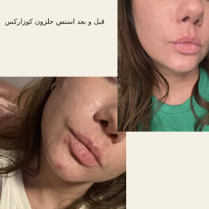 before after hair oridinary 18 510x510 8