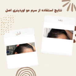 سرم ضد ریزش مو اوردینری مولتی پپتید (100%اصل+به قیمت پخش) 36 before after hair oridinary 2