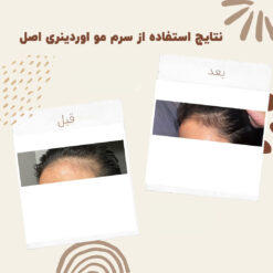 سرم ضد ریزش مو اوردینری مولتی پپتید (100%اصل+به قیمت پخش) 35 before after hair oridinary 3