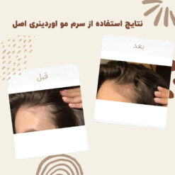 سرم ضد ریزش مو اوردینری مولتی پپتید (100%اصل+به قیمت پخش) 33 before after hair oridinary 5