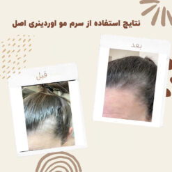سرم ضد ریزش مو اوردینری مولتی پپتید (100%اصل+به قیمت پخش) 32 before after hair oridinary 6