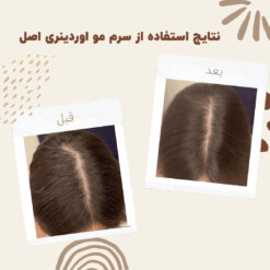 سرم ضد ریزش مو اوردینری مولتی پپتید (100%اصل+به قیمت پخش) 31 before after hair oridinary 7