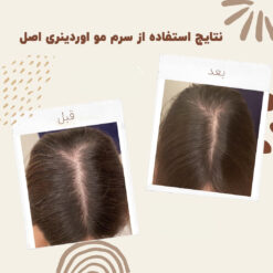 سرم ضد ریزش مو اوردینری مولتی پپتید (100%اصل+به قیمت پخش) 30 before after hair oridinary 8