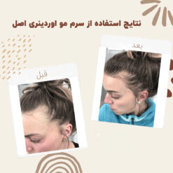 سرم ضد ریزش مو اوردینری مولتی پپتید (100%اصل+به قیمت پخش) 29 before after hair oridinary 9