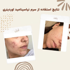 before after zhinora niasin 16