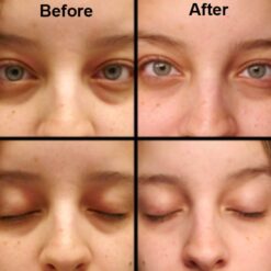 کرم دور چشم سراوی (100%اصل+به قیمت پخش) 25 ceraveeyerepaircream03 850x850 1