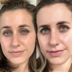 لوسیون مرطوب کننده دراماتیکال کلینیک مخصوص پوست خشک و نرمال ا Clinique Dramatically Different Moisturizing Lotion 27 clinique dramatically different moisturizing lotion 11