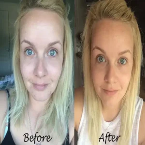 clinique dramatically different moisturizing lotion 5