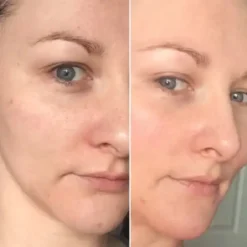 لوسیون مرطوب کننده دراماتیکال کلینیک مخصوص پوست خشک و نرمال ا Clinique Dramatically Different Moisturizing Lotion 29 clinique dramatically different moisturizing lotion 8