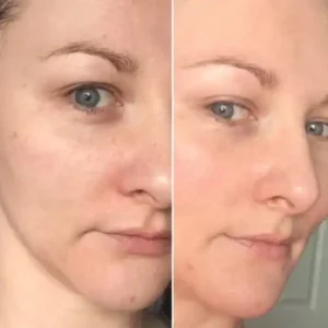 لوسیون مرطوب کننده دراماتیکال کلینیک مخصوص پوست خشک و نرمال ا Clinique Dramatically Different Moisturizing Lotion 43 clinique dramatically different moisturizing lotion 8