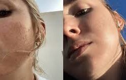 سرم رتینول سراوی پوست چرب و مختلط (100%اصل+به قیمت پخش) آبی ضد جوش 54 download