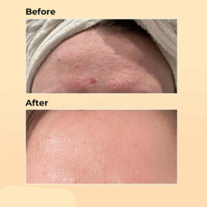 سرم حلزون کوزارکس min