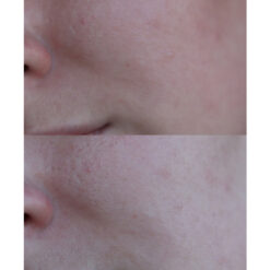 ژل شسستشو سراوی (100%اصل+به قیمت پخش) SA پوست زبر و خیلی خشک 11 شستشوی سالیسیلیک اسید سراوی CeraVe SA Smoothing Cleanser 4