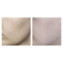 ژل شسستشو سراوی (100%اصل+به قیمت پخش) SA پوست زبر و خیلی خشک 12 شستشوی سالیسیلیک اسید سراوی CeraVe SA Smoothing Cleanser 5