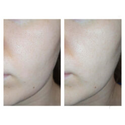 ژل شسستشو سراوی (100%اصل+به قیمت پخش) SA پوست زبر و خیلی خشک 14 شستشوی سالیسیلیک اسید سراوی CeraVe SA Smoothing Cleanser 6