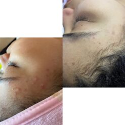 فوم شستشوی صورت سراوی پوست چرب و نرمال (اصل+به قیمت پخش) 28 71OhjUfypFL