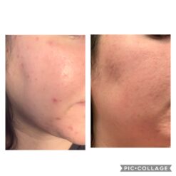 فوم شستشوی صورت سراوی پوست چرب و نرمال (اصل+به قیمت پخش) 29 71qgiC4UA7L