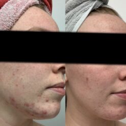 فوم شستشوی صورت سراوی پوست چرب و نرمال (اصل+به قیمت پخش) 30 71wpwvZXnL