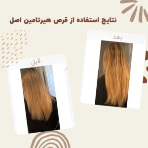 before after hairtamin 3 1