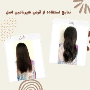 before after hairtamin 4 1