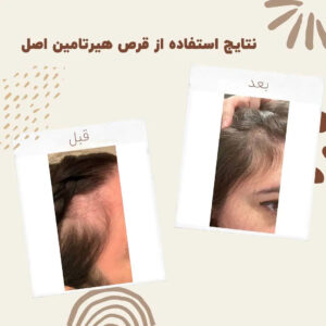 before after hairtamin 5 1