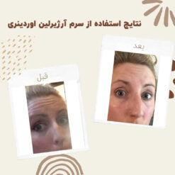 سرم آرژیرلین اوردینری (100%اصل+ارسال فوری) 10درصد 8 before after zhinora ordinary argireline 5 min