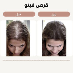 قرص فیتو اصل (به قیمت پخش+ارسال فوری) 15 فیتو 10