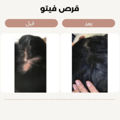 قرص فیتو اصل (به قیمت پخش+ارسال فوری) 14 فیتو 11