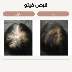 قرص فیتو اصل (به قیمت پخش+ارسال فوری) 21 فیتو 3