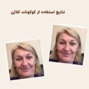 before after myvitamins coconut collagen 1