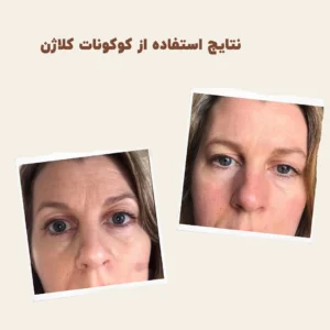 before after myvitamins coconut collagen 2