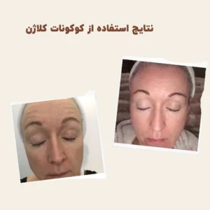 before after myvitamins coconut collagen 4