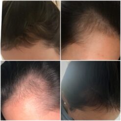 کپسول پریورین بایر ضدریزش هورمونی و ارثی آلمانی (اصل+به قیمت پخش) 38 61BG9ZcENIL