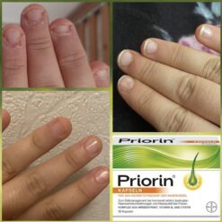 کپسول پریورین بایر ضدریزش هورمونی و ارثی آلمانی (اصل+به قیمت پخش) 40 61dGau1gOLL