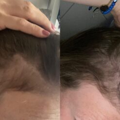 کپسول پریورین بایر ضدریزش هورمونی و ارثی آلمانی (اصل+به قیمت پخش) 41 61oKQU0fh2L