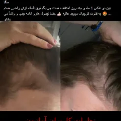 کپسول پریورین بایر ضدریزش هورمونی و ارثی آلمانی (اصل+به قیمت پخش) 50 Screenshot 292