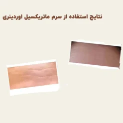 سرم ماتریکسیل اوردینری 3000 (اورجینال+ارسال فوری) 10 درصد 7 before after Matrixyl 2 min