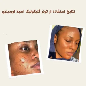 before after The Ordinary Glycolic 7 Toning 3 min