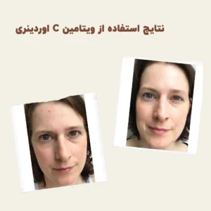 before after ordinary vitamin C suspension 01 min 1