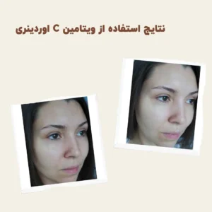 before after ordinary vitamin C suspension 02 min 1