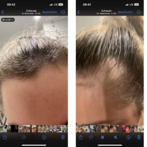 before after priorin 2