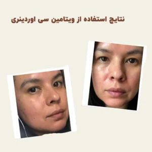 before after vitamin c 1 min 1