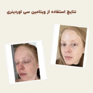 before after vitamin c 2 min 1