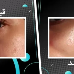 سرم اسکوربیک اسید اوردینری ویتامین سی 8%+ آلفا آربوتین 2% 16 file 13