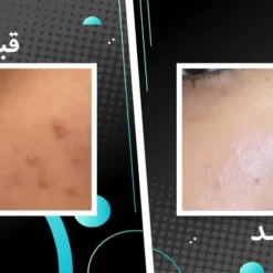 سرم اسکوربیک اسید اوردینری ویتامین سی 8%+ آلفا آربوتین 2% 15 file 14