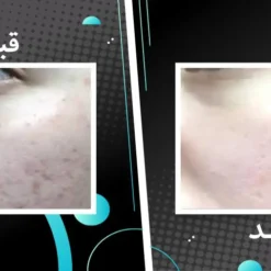 سرم اسکوربیک اسید اوردینری ویتامین سی 8%+ آلفا آربوتین 2% 14 file 15