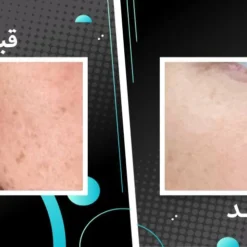 سرم اسکوربیک اسید اوردینری ویتامین سی 8%+ آلفا آربوتین 2% 13 file 16